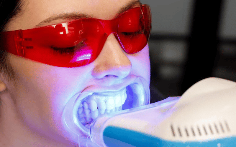 is laser teeth whitening safe for your teeth